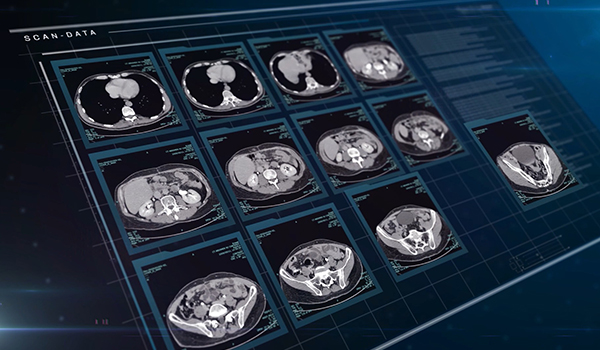 Pioneering the future of healthcare with image processing and AI technologies