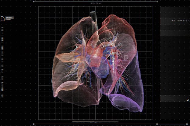 手術とFUJIFILM 心臓の3D解析の様子