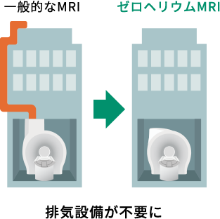 説明図：一般的なMRIとゼロヘリウムMRIの設備