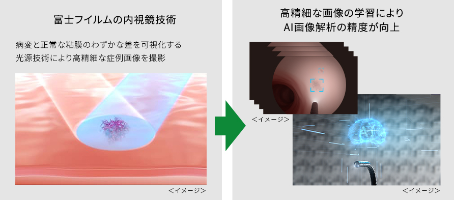 説明図：AI開発を支えた富士フイルムの内視鏡技術